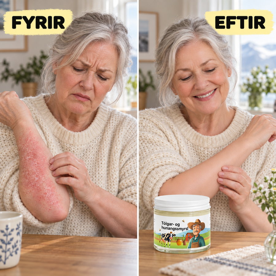 Fingurgómur tekur baunarstórt magn af smyrsli úr krukkunni